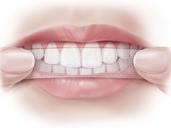 Kako uporabljati belilne trakove za zobe?