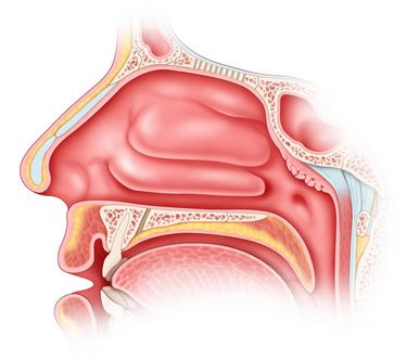 Vasomotorni rinitis