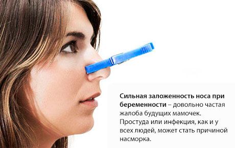 Zamašitev nosu med nosečnostjo